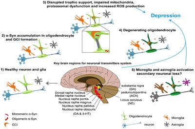 Depression in multiple system atrophy: Views on pathological, clinical and imaging aspects